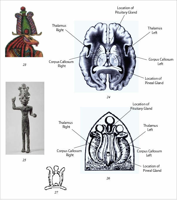 Egyptian Model of the Brain 